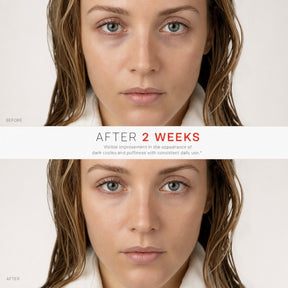 LUMUWA Elys™ Red Light Eye Therapy Wand